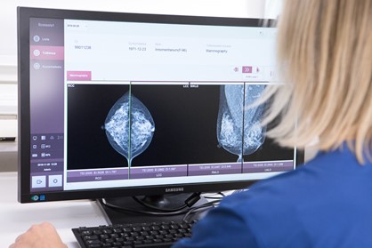 Valokuva, jossa tutkitaan tietokoneen näytöltä mammografiakuvia.